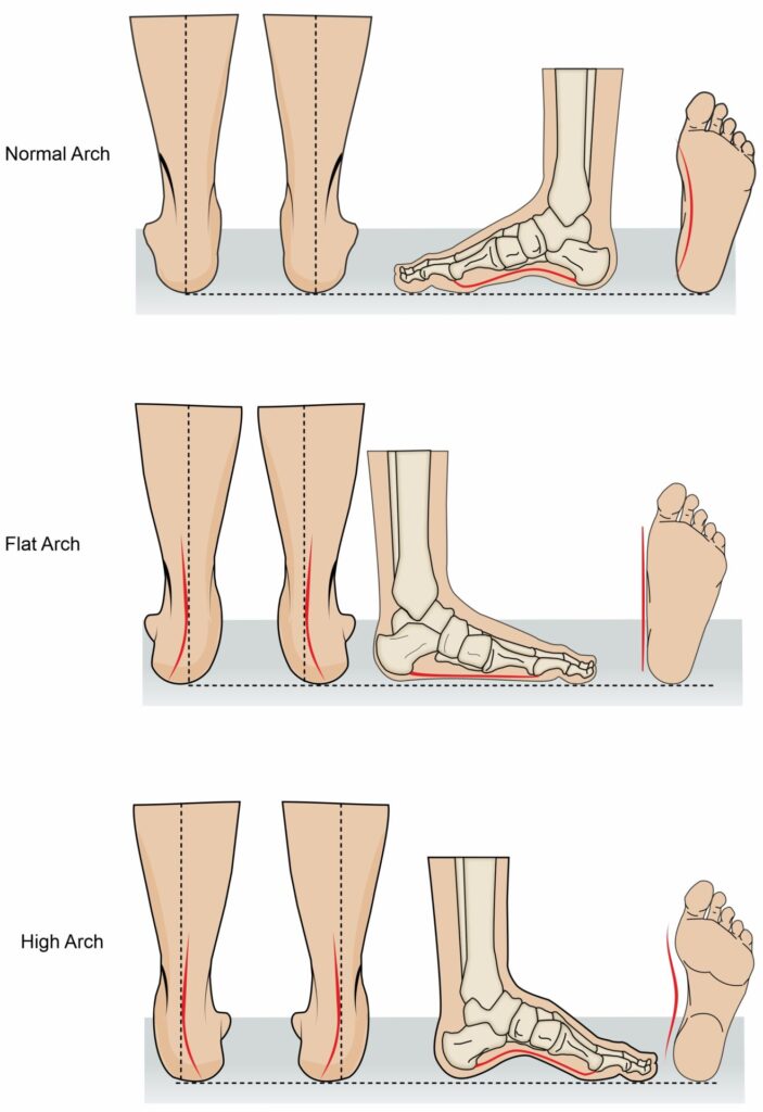 Feet